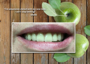 Natural Dentures & Implant Center New Smile After