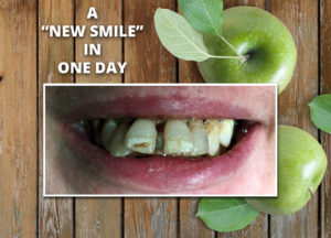 Natural Dentures & Implant Center New Smile Before